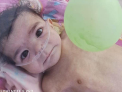 Save 6.5-Month-Old Omar